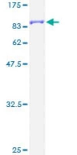Novus Biologicals Recombinant Human CaM Kinase II gamma GST (N-Term) Protein 2 &mu;g | Buy Online | Novus Biologicals&trade; | Fisher Scientific