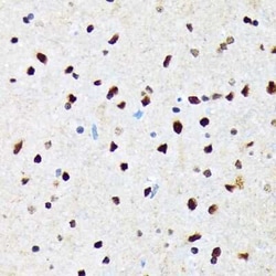 CaMKIV Rabbit anti-Human, Mouse, Rat, Clone: 1G4P4, Novus Biologicals 100 &mu;g | Buy Online | Novus Biologicals | Fisher Scientific