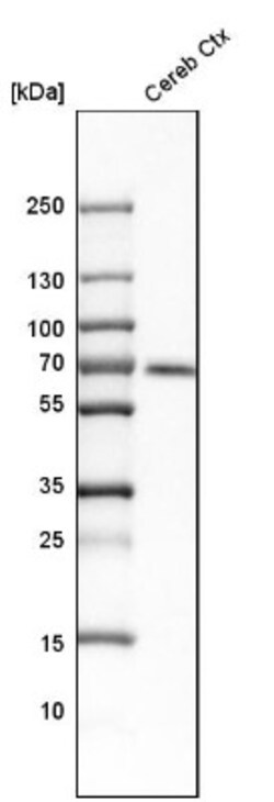Integrin alpha 6/CD49f Antibody, Novus Biologicals:Antibodies:Primary Antibodies