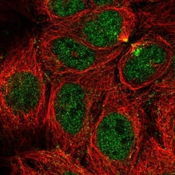 CaMKV Antibody, Novus Biologicals 0.1mL; Unlabeled:Antibodies, Polyclonal
