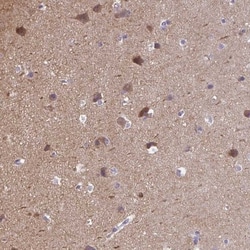 CaMKV Antibody, Novus Biologicals 0.1mL; Unlabeled:Antibodies, Polyclonal