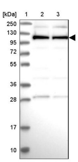 LIM kinase 2 Antibody, Novus Biologicals:Antibodies:Primary Antibodies