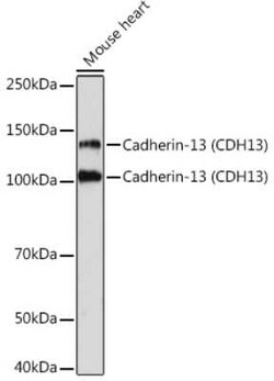 Cadherin-13 Rabbit anti-Human, Mouse, Rat, Clone: 4Z8D1, Novus Biologicals 20 &mu;g | Buy Online | Novus Biologicals | Fisher Scientific