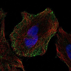 Cadherin-13 Antibody, Novus Biologicals 0.1mL; Unlabeled:Antibodies, Polyclonal