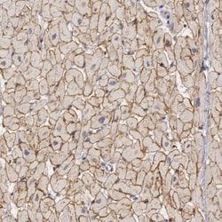Cadherin-13 Antibody, Novus Biologicals 0.1mL; Unlabeled:Antibodies, Polyclonal