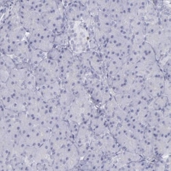 Cadherin-13 Antibody, Novus Biologicals 0.1mL; Unlabeled:Antibodies, Polyclonal