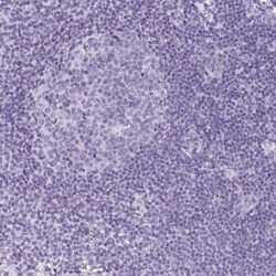 Cadherin-16 Antibody, Novus Biologicals 0.1mL; Unlabeled:Antibodies, Polyclonal