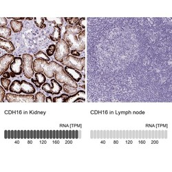 Cadherin-16 Antibody, Novus Biologicals 0.1mL; Unlabeled:Antibodies, Polyclonal