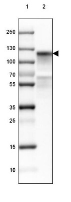 Cadherin-16 Antibody, Novus Biologicals 0.1mL; Unlabeled:Antibodies, Polyclonal