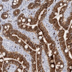 Cadherin-17 Antibody, Novus Biologicals:Antibodies:Primary Antibodies