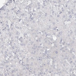 Cadherin-17 Antibody, Novus Biologicals:Antibodies:Primary Antibodies