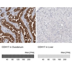 Cadherin-17 Antibody, Novus Biologicals:Antibodies:Primary Antibodies