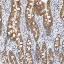 Cadherin-17 Antibody, Novus Biologicals 0.1mL; Unlabeled:Antibodies, Polyclonal