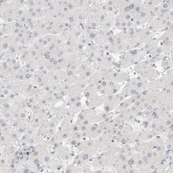 Cadherin-17 Antibody, Novus Biologicals 0.1mL; Unlabeled:Antibodies, Polyclonal