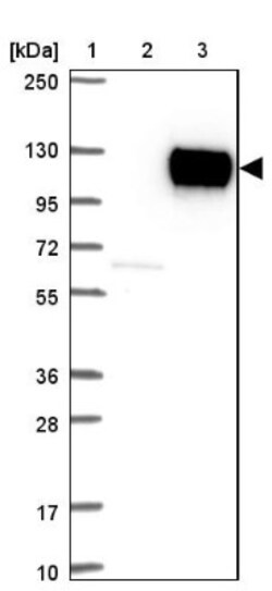 Cadherin-17 Antibody, Novus Biologicals 0.1mL; Unlabeled:Antibodies, Polyclonal