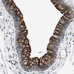 Cadherin-26 Antibody, Novus Biologicals 0.1mL; Unlabeled:Antibodies, Polyclonal