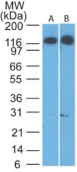 Cadherin-4/R-Cadherin Antibody, Novus Biologicals 0.025mg; Unlabeled:Antibodies,