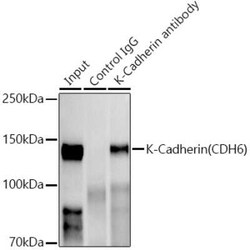 Cadherin-6/KCAD Rabbit anti-Human, Mouse, Rat, Clone: 5N2K3, Novus Biologicals 20 &mu;g | Buy Online | Novus Biologicals | Fisher Scientific