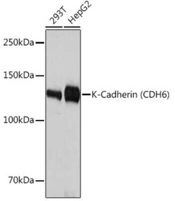 Cadherin-6/KCAD Rabbit anti-Human, Mouse, Rat, Clone: 5N2K3, Novus Biologicals 20 &mu;g | Buy Online | Novus Biologicals | Fisher Scientific