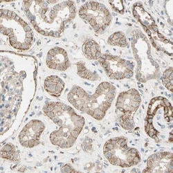 Cadherin-6/KCAD Antibody, Novus Biologicals 0.1mL; Unlabeled:Antibodies,