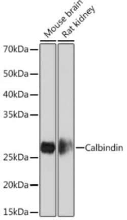 Calbindin D-28K Rabbit anti-Mouse, Rat, Clone: 1K2K2, Novus Biologicals:Antibodies:Primary
