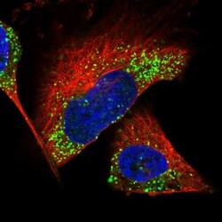 Calbindin D-28K Antibody, Novus Biologicals 25 &mu;L; Unlabeled:Antibodies,