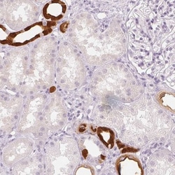 Calbindin D-28K Antibody, Novus Biologicals 25 &mu;L; Unlabeled:Antibodies,