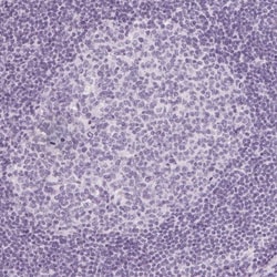 Calbindin D-28K Antibody, Novus Biologicals 25 &mu;L; Unlabeled:Antibodies,