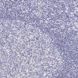 Calbindin D-28K Antibody, Novus Biologicals:Antibodies:Primary Antibodies