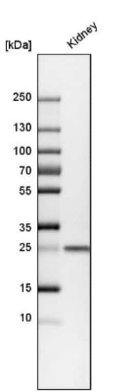 Calbindin D-28K Antibody, Novus Biologicals 25 &mu;L; Unlabeled:Antibodies,