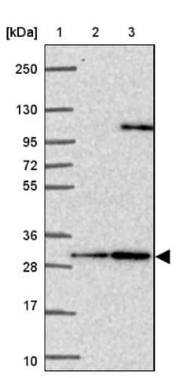 Calbindin D-28K Antibody, Novus Biologicals:Antibodies:Primary Antibodies