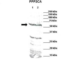 Calcineurin A Antibody, Novus Biologicals:Antibodies:Primary Antibodies