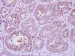 Calcineurin B Antibody, Novus Biologicals 0.1mL; Unlabeled:Antibodies,
