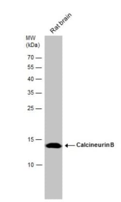 Calcineurin B Antibody, Novus Biologicals 0.1mL; Unlabeled:Antibodies,