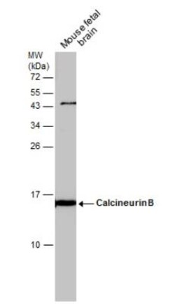 Calcineurin B Antibody, Novus Biologicals 0.1mL; Unlabeled:Antibodies,