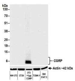 Calcitonin Antibody (BLR169J), Novus Biologicals 100 &mu;g | Buy Online | Bio-Techne | Fisher Scientific