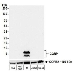 Calcitonin Antibody (BLR169J), Novus Biologicals 100 &mu;g | Buy Online | Bio-Techne | Fisher Scientific