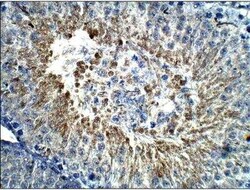Calcitonin Antibody, Novus Biologicals 100 &mu;g; Unconjugated:Antibodies,