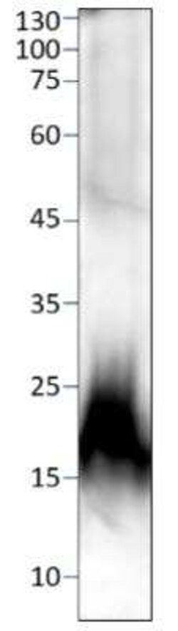 Calcitonin Antibody, Novus Biologicals 100 &mu;g; Unconjugated:Antibodies,