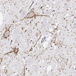 Calcitonin R Antibody, Novus Biologicals:Antibodies:Primary Antibodies