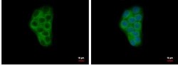 Calcium-binding-protein-P22 Antibody, Novus Biologicals 0.1mg; Unlabeled:Antibodies,