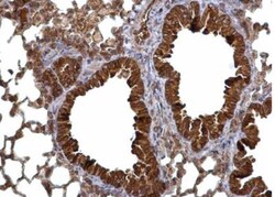 Calcium-binding-protein-P22 Antibody, Novus Biologicals 0.1mg; Unlabeled:Antibodies,