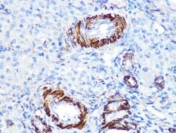 Caldesmon/CALD1 Rabbit anti-Human, Rat, Clone: 6M5Q9, Novus Biologicals