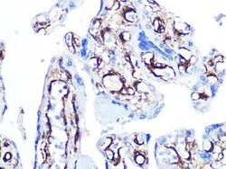 Caldesmon/CALD1 Rabbit anti-Human, Rat, Clone: 6M5Q9, Novus Biologicals