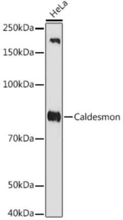Caldesmon/CALD1 Rabbit anti-Human, Rat, Clone: 6M5Q9, Novus Biologicals