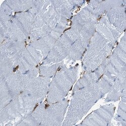 Caldesmon/CALD1 Antibody, Novus Biologicals:Antibodies:Primary Antibodies