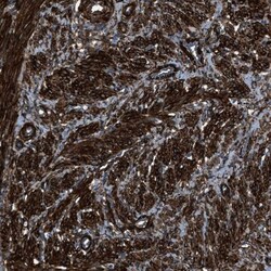 Caldesmon/CALD1 Antibody, Novus Biologicals:Antibodies:Primary Antibodies