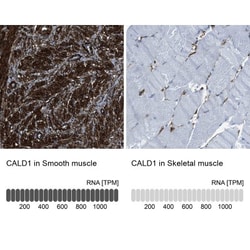 Caldesmon/CALD1 Antibody, Novus Biologicals:Antibodies:Primary Antibodies