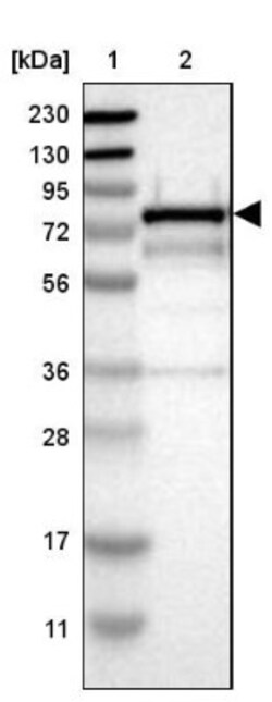 Caldesmon/CALD1 Antibody, Novus Biologicals:Antibodies:Primary Antibodies