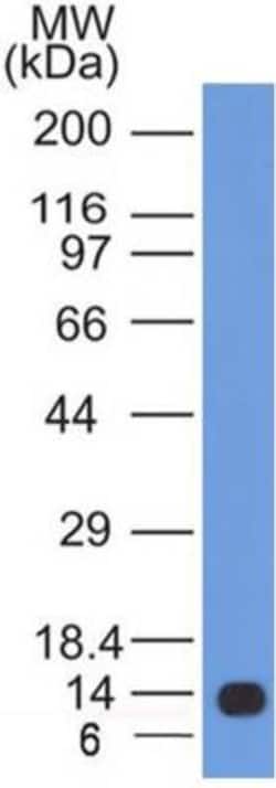 Calnexin Antibody (IE2.1C12) - BSA Free, Novus Biologicals:Antibodies:Primary